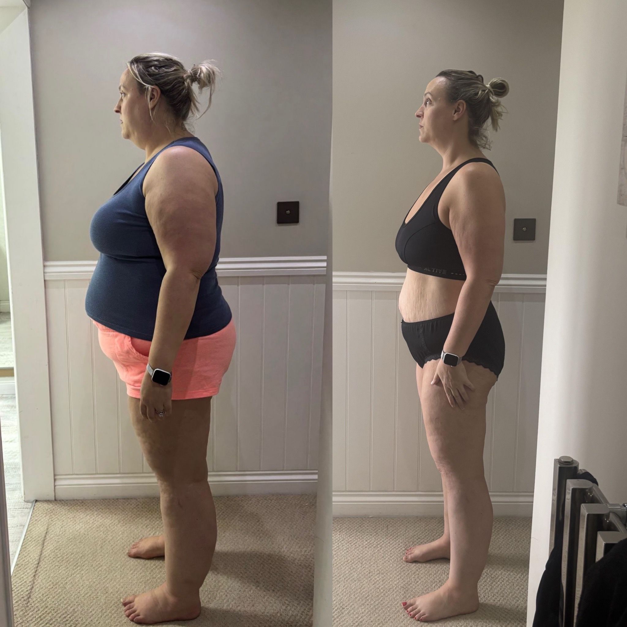 Emma — before and after